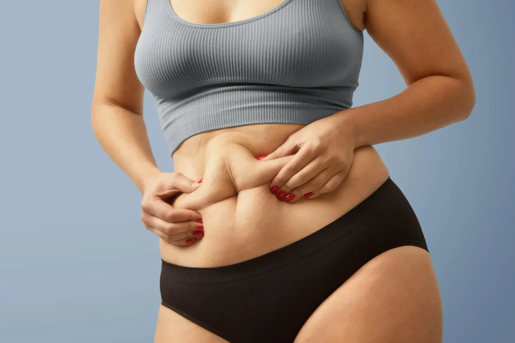 barriga hormonal na menopausa