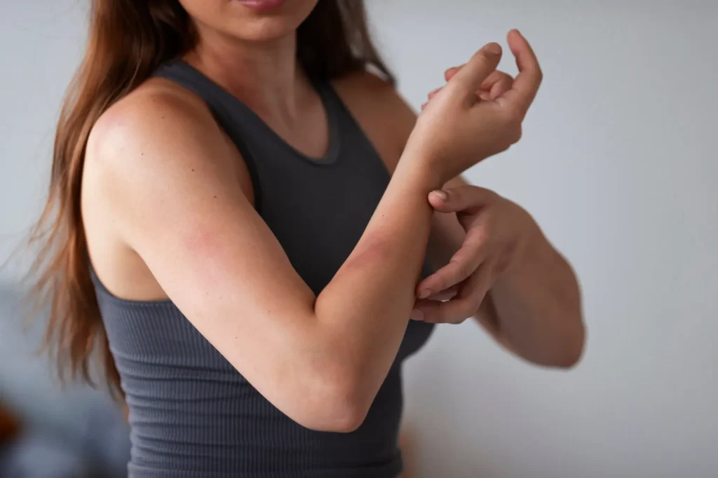 menopausa causa coceira no corpo