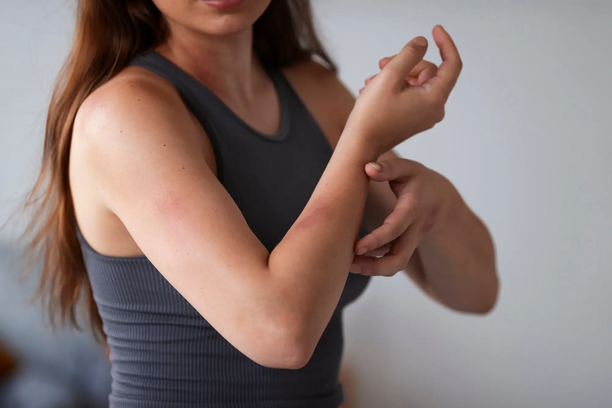menopausa causa coceira no corpo
